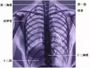 影像园 胸廓的正位x线解剖  正位胸片上主要的影像解剖特点有: ①胸骨