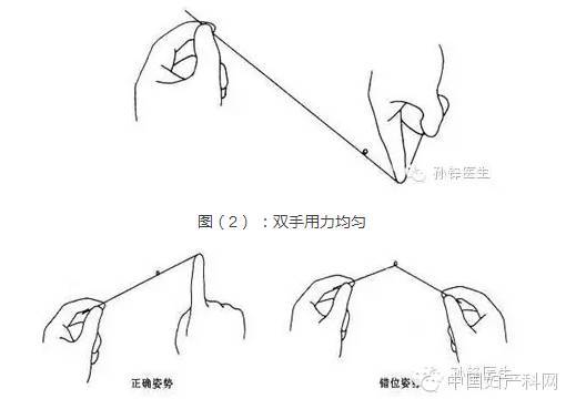 打结整个过程中线始终都应保持恰当的张力,这样结就不