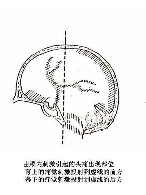 头痛的解剖结构分析