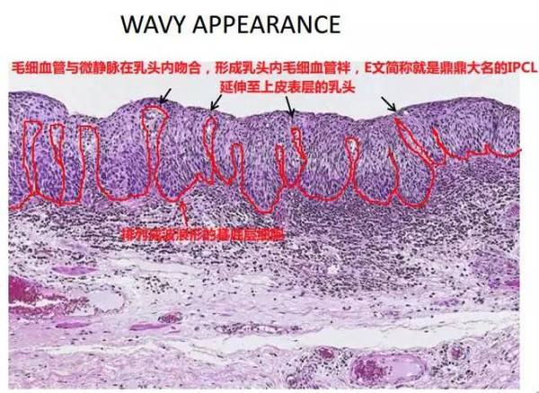 这是波浪形的基底膜,也还是连续的.