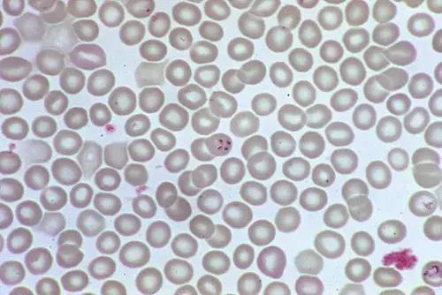 显微镜下被巴贝西虫感染的红细胞(图片来自:http://www.livescience.