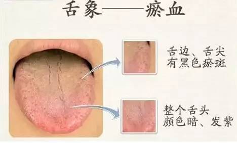 【专家养生】舌诊,是一门可以窥探身体秘密的技术