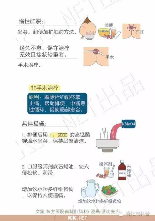 难以启齿的肛裂