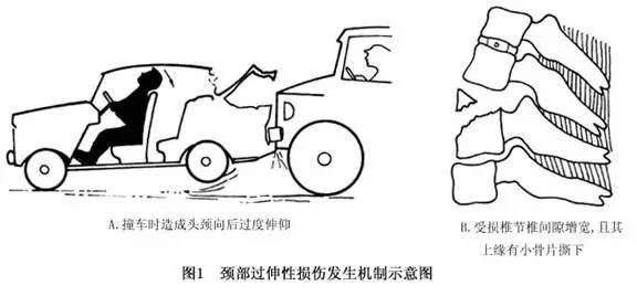 一言不合就撞车 然后呢? | 真相