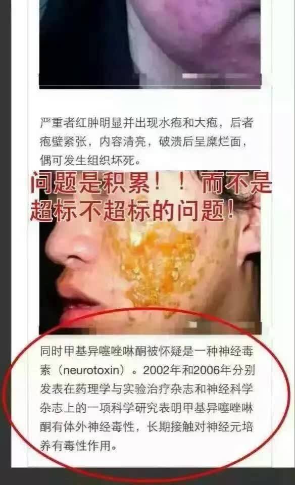 化妆品过敏源头,你了解有多少?