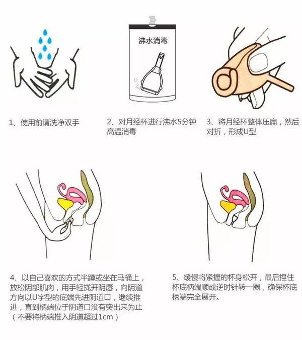 月事杯使用方法 卫生棉条