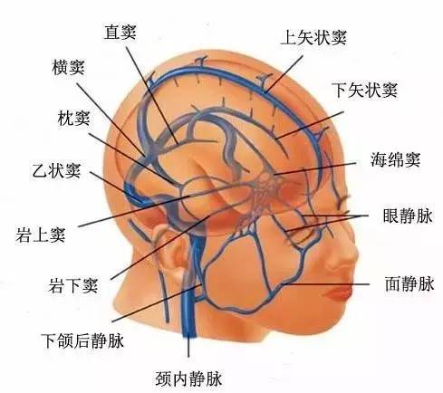 脑供血系统分类,你搞清楚过吗?