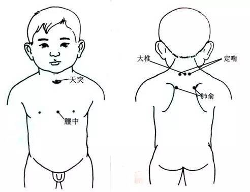 西苑"三伏贴"之儿科