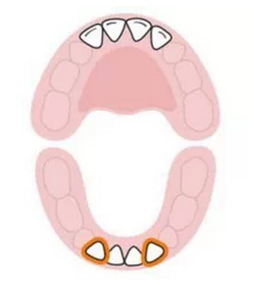 科普:各位妈妈,你知道宝宝长牙的顺序吗?