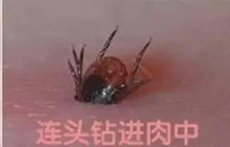 紧急扩散!恙虫高发被咬或致死亡, 厦门已有人中招!