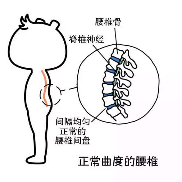 弯腰的姿势会破坏腰椎的生理曲度,让腰椎变直甚至反弓,从而对腰椎间盘