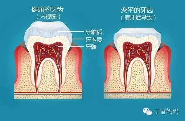 孩子磨牙,是肚子里有蛔虫吗?