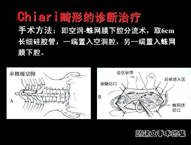 成语畸什么畸_成语故事图片(2)