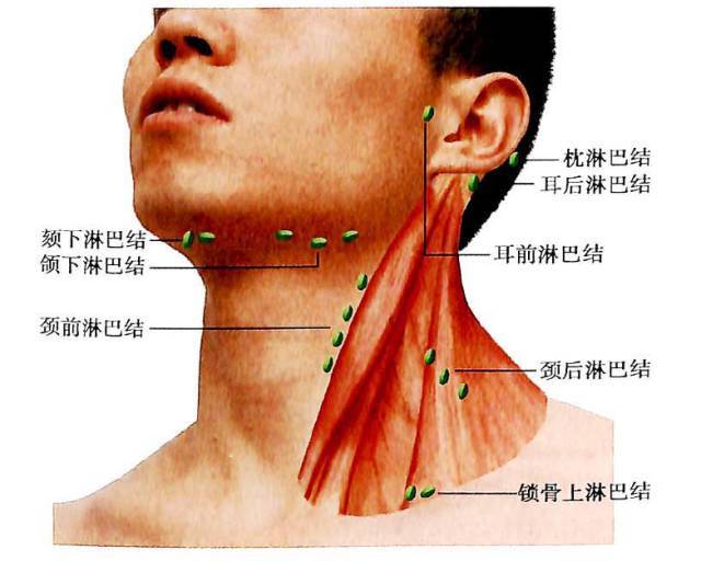 1 颌下淋巴结肿大 这里的淋巴结肿大,一般都是和口腔,脸颊
