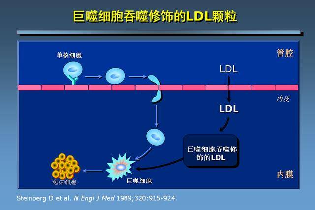 动脉粥样硬化的形成的机理