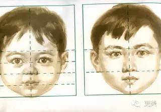 因为骨骼尚未发育成熟的儿童面部比例,就是眼距较宽啊!
