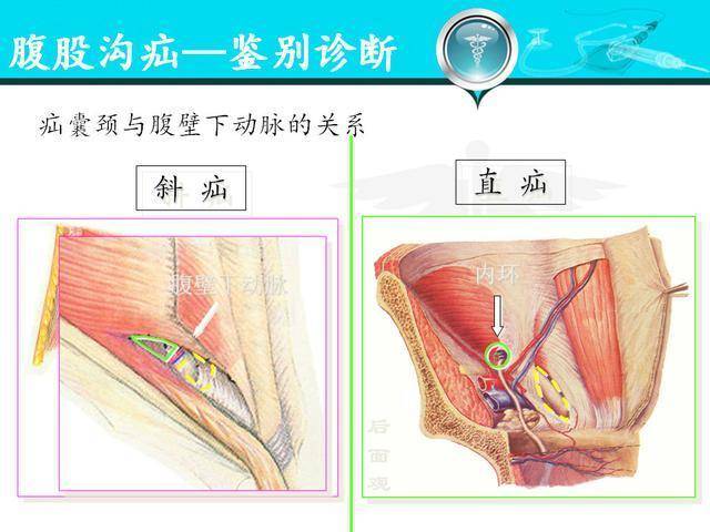 附:详细图解