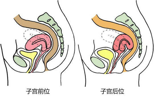 怀孕绞病是什么原理_绞龙砂是什么砂子(2)