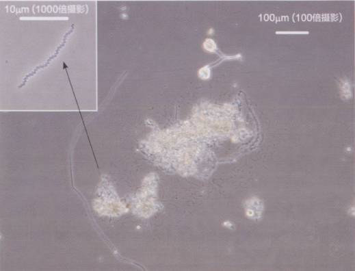 4)活性污泥中累枝虫,木盾纤虫,裂口虫,钟虫的数量呈增长趋势时,表明