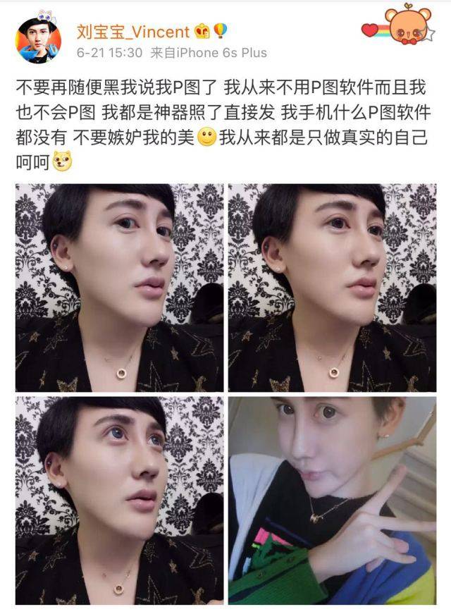 蛇精男刘梓晨满脸玻尿酸,照片太辣眼睛,你还敢点进来吗?