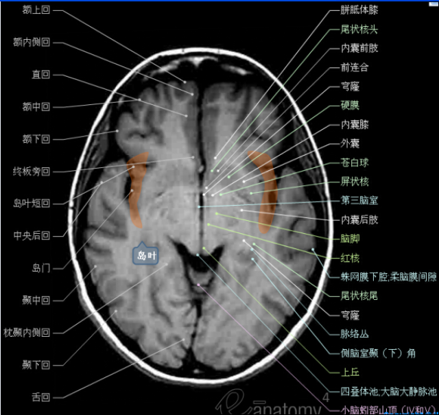 大集合!颅脑轴向结构解剖图