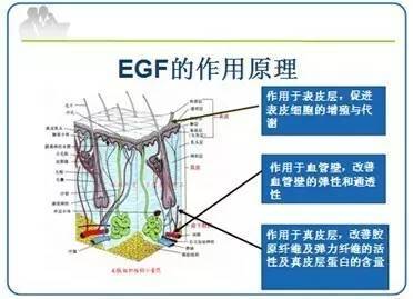 egf(表皮生长因子)可以直达皮肤细胞内部,为皮肤细胞补充蛋白质能量