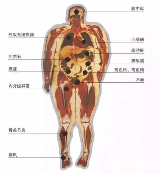 【恐怖】200斤胖子解剖全过程,胆小慎入!