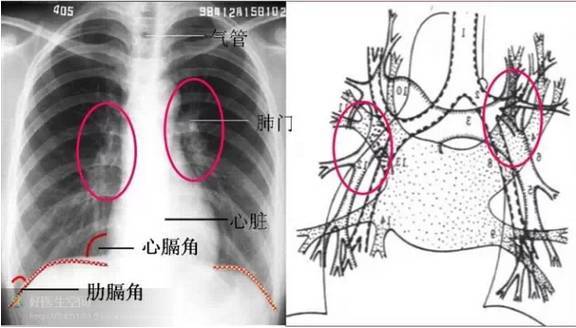 肺纹理的走行代表代表肺叶及肺段的解剖学结构.