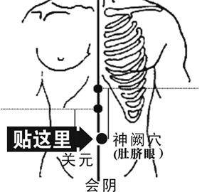 贴肚脐治痔疮的原理是什么_女士痔疮是长什么样子(2)