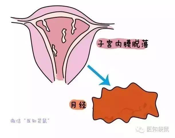 痛经是指月经前后或月经期出现下腹部疼痛,坠