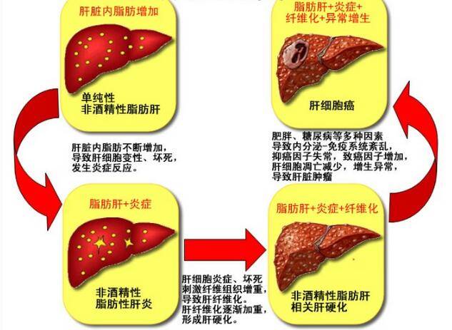 全力的来支援肝脏,增强肝脏的解毒功能,让肝脏于最巅峰状态下制造胆汁