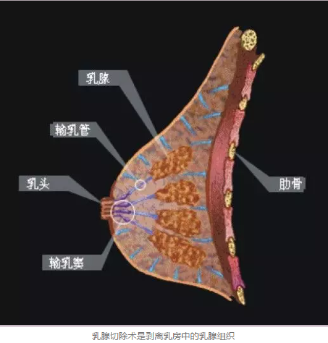 乳腺外侧切口以及乳腺组织边缘为界,内侧切口以腹中线为界.