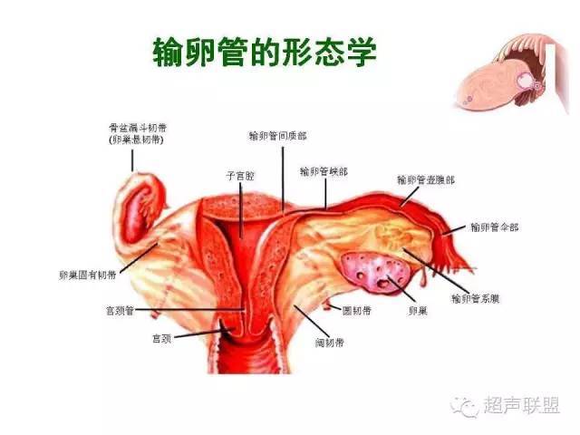 输卵管3d/4d超声造影的临床应用研究