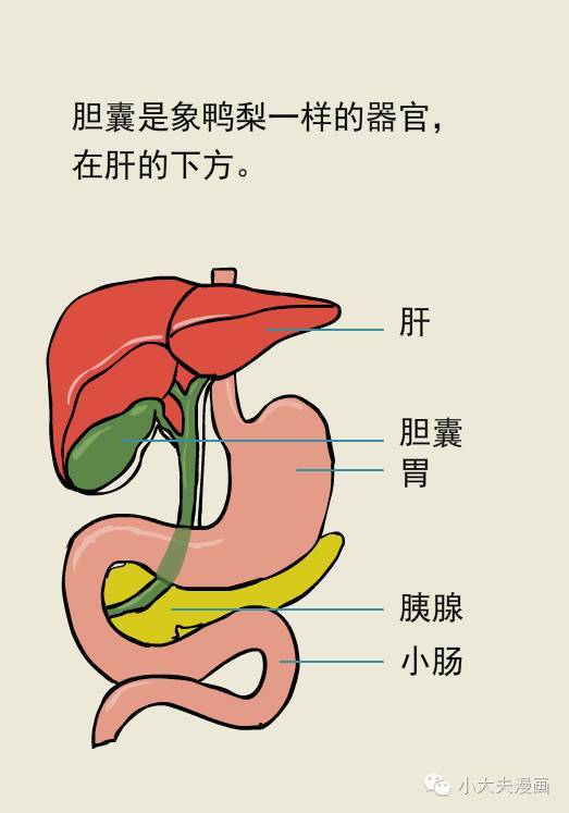 胆结石一定要切胆吗?