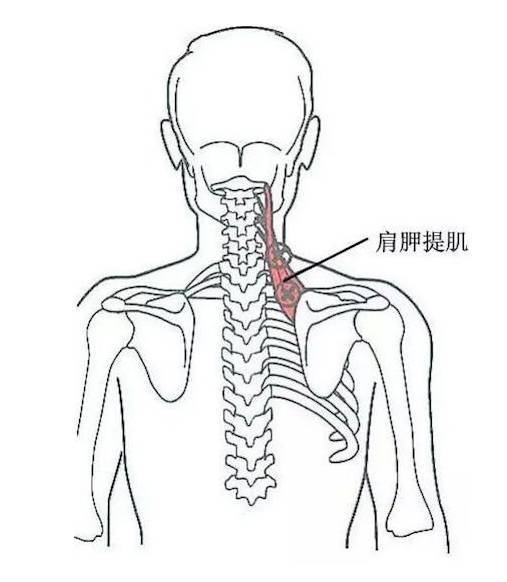 肩胛提肌的松解与拉伸