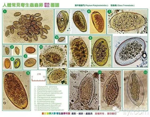 台北医学大学精美寄生虫虫卵图(超清晰,收藏吧)