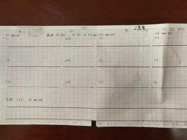 医院提供了两张心电图,分别是12:32,13:01,都是一条直线.