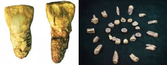 科学家们正是通过对云南元谋人牙齿化石(170万年前),北京猿人牙齿化石