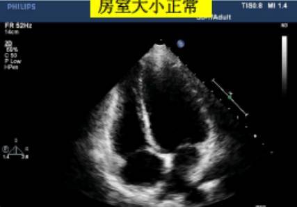 超声心动图数据测量_手机搜狐网