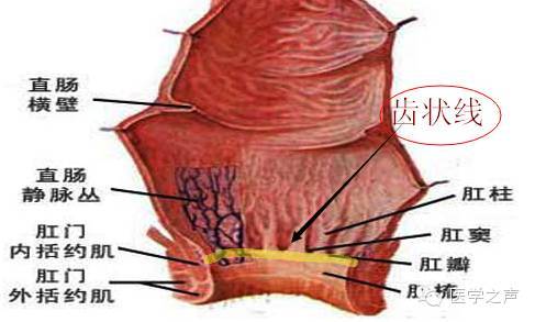 图文说内痔外痔混合痔怎么区分