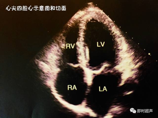 六 胸骨旁心尖短轴切面 七 心尖四腔心示图和切面 八 心尖五腔心切面