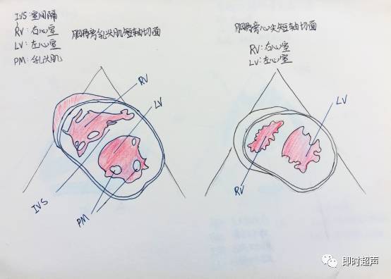 三 胸骨旁肺动脉长轴切面 四 二尖瓣口水平短轴切面 五 胸骨旁乳头肌