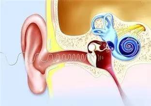 全球首例双侧人工耳蜗同期植入案例完成|医生