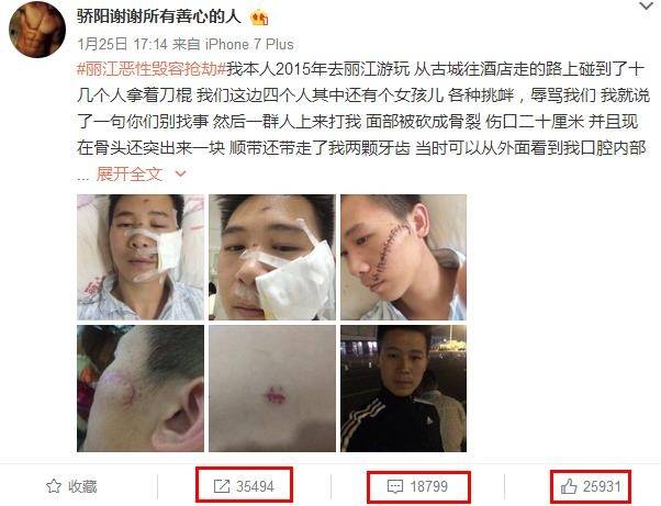 有关"女游客在丽江遭暴打致毁容"一案,无疑是今天最热话题,且由该