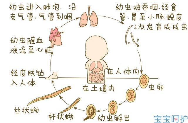 5招教你判断宝宝肚子里有没有虫!