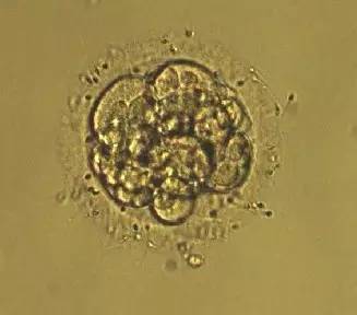 我该如何阅读d3胚胎移植报告呢? ——卵裂期胚胎评分