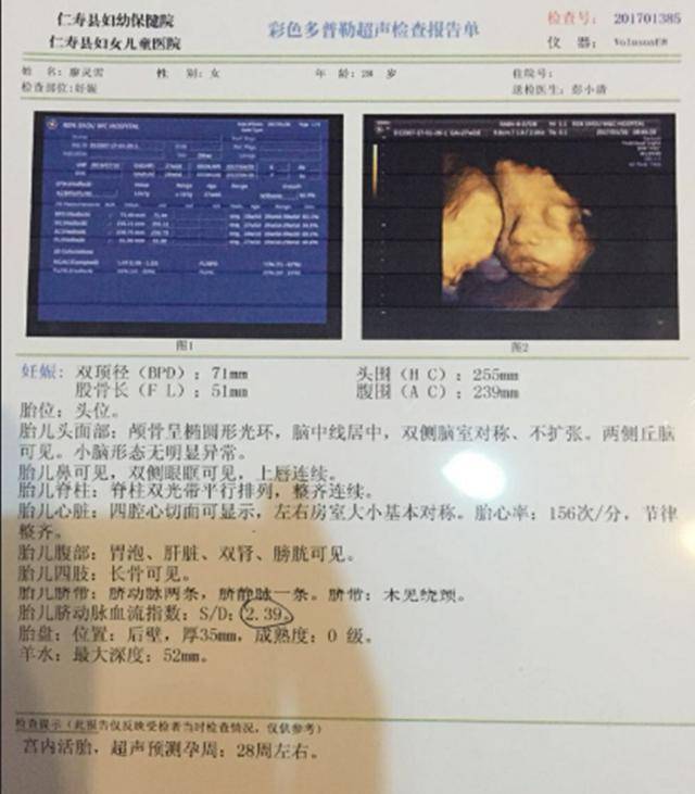 孕29周b超确认男宝一枚原来怀男娃胎动竟是这样