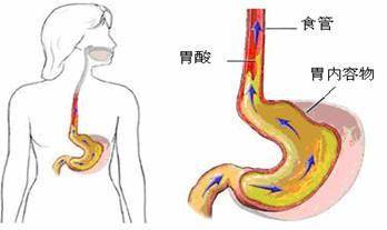 胃疼胃疼,读完这篇文章看到底是不是胃疼?