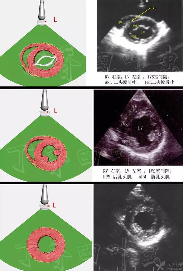 心脏解剖笔记:图解超声切面