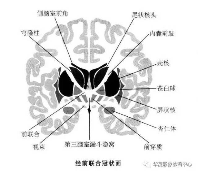 【影像基础】值得收藏的基底节及周围区域解剖详图